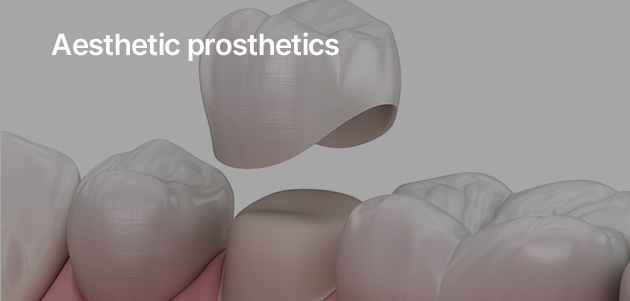 Aesthetic prosthetics